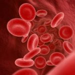 Sindrom Antifosfolipid: Gangguan Autoimun yang Meningkatkan Risiko Penggumpalan Darah