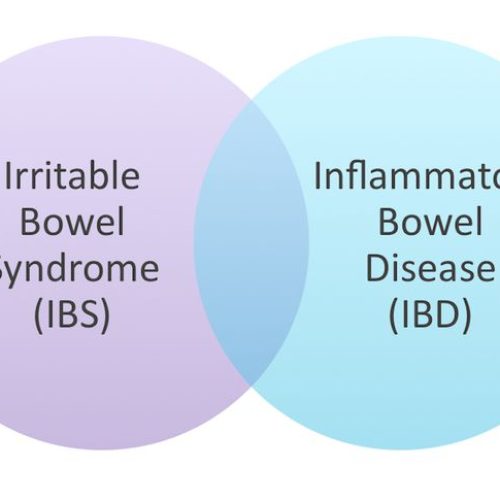 Mari mengenal lebih jauh mengenai Inflammatory Bowel Disease (IBD) dan Irritable Bowel Syndrome (IBS)