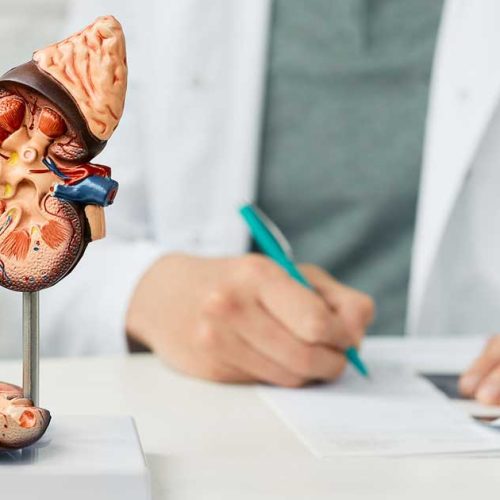 Nefritis Lupus: Saat Sistem Imun Menyerang Ginjal Sendiri