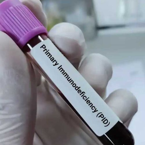 Mengenal Primary Immunodeficiency (PID): Gangguan Kekebalan Tubuh Bawaan