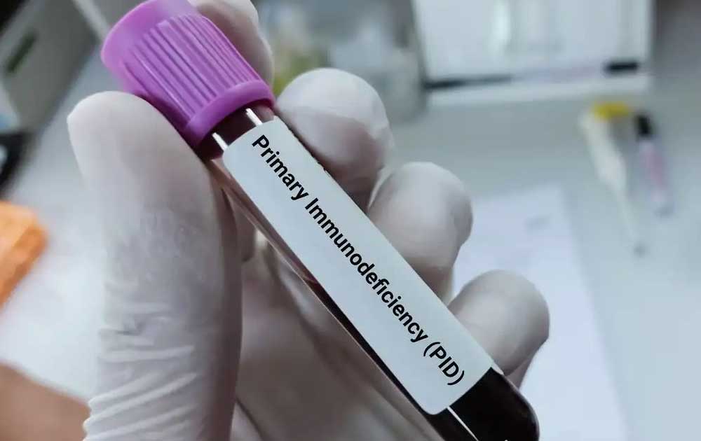 Read more about the article Mengenal Primary Immunodeficiency (PID): Gangguan Kekebalan Tubuh Bawaan