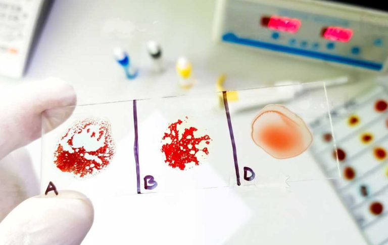 Inkompatibilitas Golongan Darah: Memahami Reaksi Imun di Baliknya