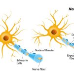 Multiple Sclerosis: Saat Sistem Imun Menyerang Sistem Saraf