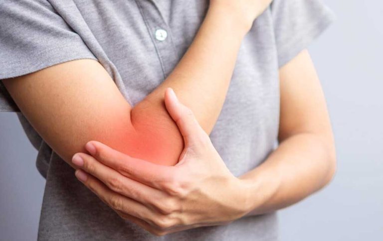 Dermatomyositis: Saat Sistem Imun Menyerang Otot dan Kulit