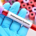 Kenali Antiphospholipid Syndrome: Gangguan Pembekuan Darah akibat Autoimun