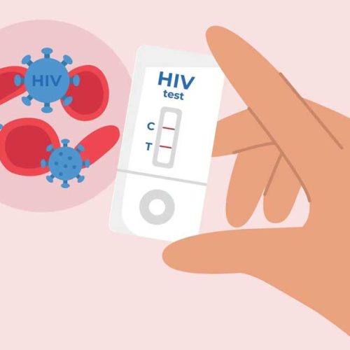 Diagnosis HIV: Kenali Sejak Dini untuk Cegah Penularan