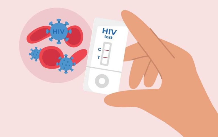 Diagnosis HIV: Kenali Sejak Dini untuk Cegah Penularan