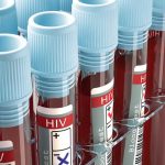 HIV Bisa Dicegah: Langkah Efektif Melindungi Diri dan Lingkungan