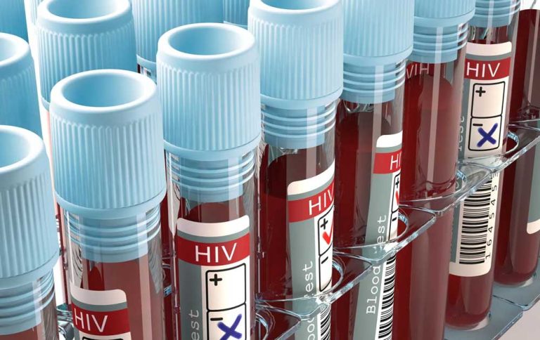 HIV Bisa Dicegah: Langkah Efektif Melindungi Diri dan Lingkungan